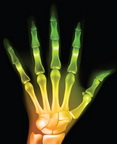 Stressed finger joints? This is another exmaple of the use of X-ray in medical diagnosis.